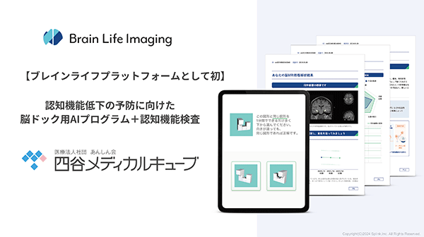 アイキャッチ：「Brain Life Imaging® +」、四谷メディカルキューブで導入