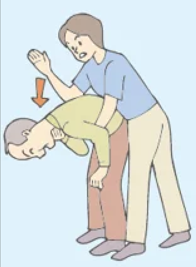 【図２】背部叩打法（出典：赤十字健康生活支援講習教本）