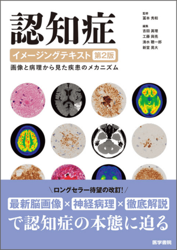 新刊『認知症イメージングテキスト 第2版』 | 認知症ねっと